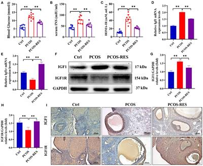 Resveratrol regulates insulin resistance to improve the glycolytic pathway by activating SIRT2 in PCOS granulosa cells